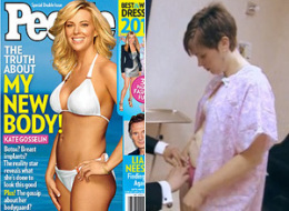 Kate Gosselin: The Before and After!